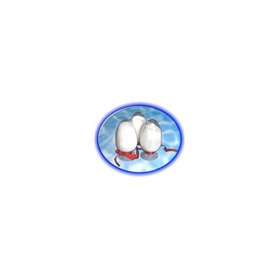 供應聚丙烯酰胺  聚丙烯酰胺特性  聚丙烯酰胺作用原理簡介